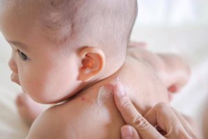 Mẹ nên làm gì khi da trẻ sơ sinh bị khô?