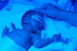 Trẻ sơ sinh bị vàng da: Nguyên nhân, phương pháp điều trị?